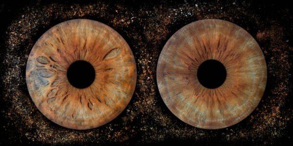 2 iris - DUO – Image 4