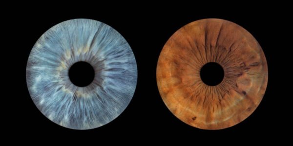 2 iris - DUO – Image 2