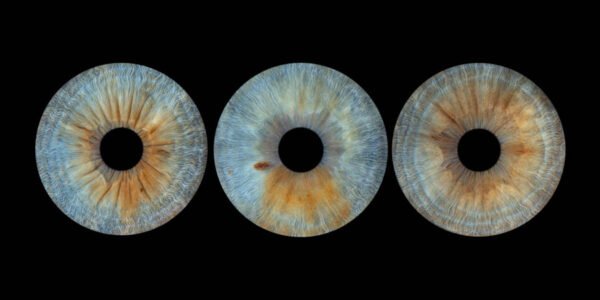 3 iris - TRIO – Image 6