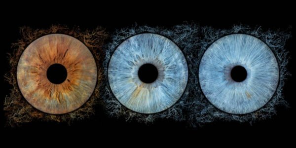 3 iris - TRIO – Image 5